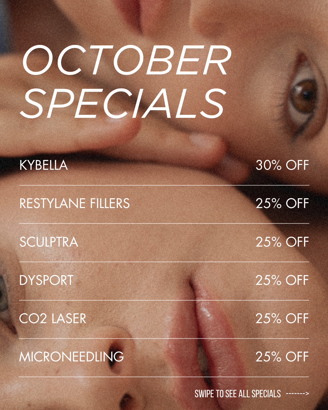 Bloom Spa October specials flyer – 25% off Dysport, Restylane fillers, Sculptra, CO₂ laser, microneedling, and 30% off Kybella at Riverside, Temecula, and Redlands

Caption: